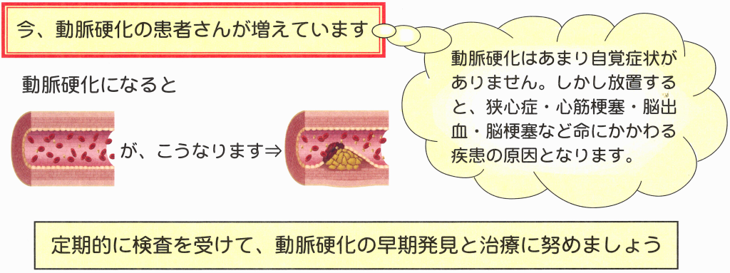 動脈硬化